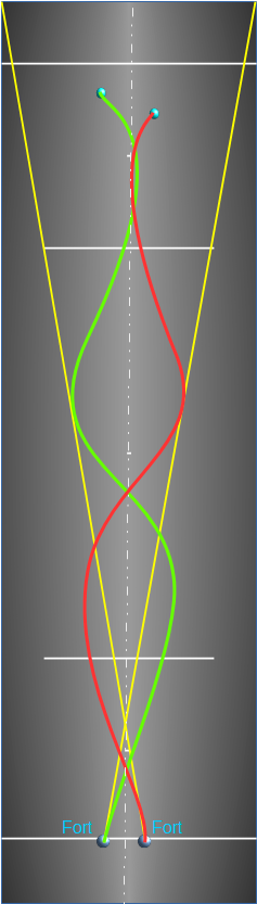 Trajectoire 1 : La simple à tomber